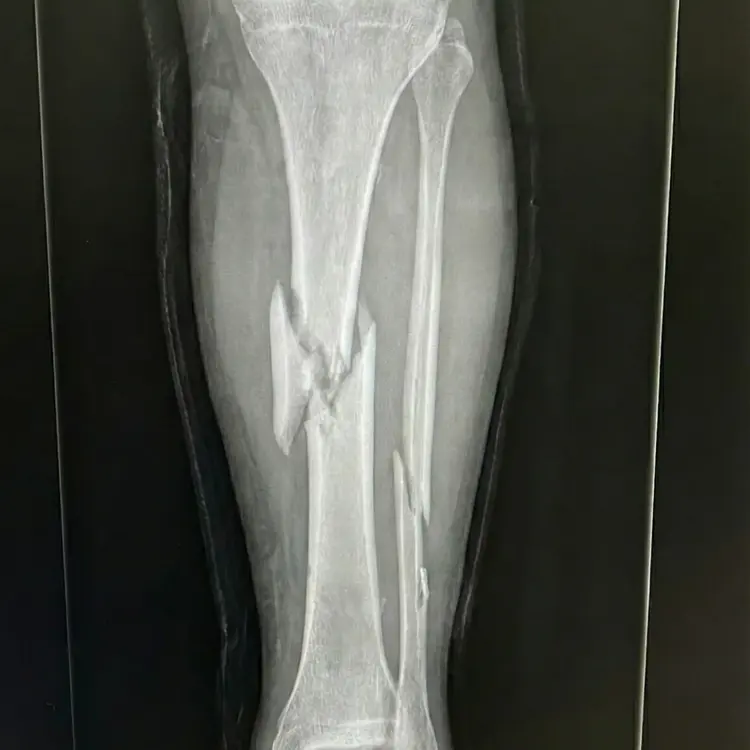 Vitor no hospital